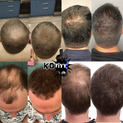Kofiyy Haare Camouflage